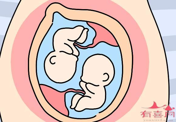 乌克兰供卵试管三代代怀选择ICRM-乌克兰供卵代生自怀所有