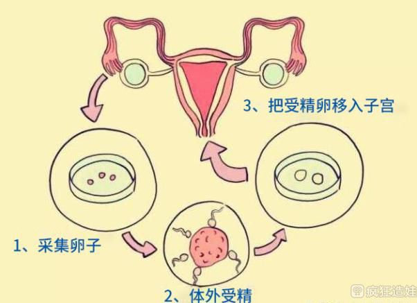 新生儿划重点+5种快速有效消除婴儿痱子的方法呈上