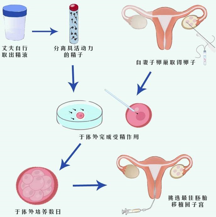 河北石家庄真后悔供卵试管代怀费用表婴儿,石家庄允许单身试管代怀的价费用婴儿吗