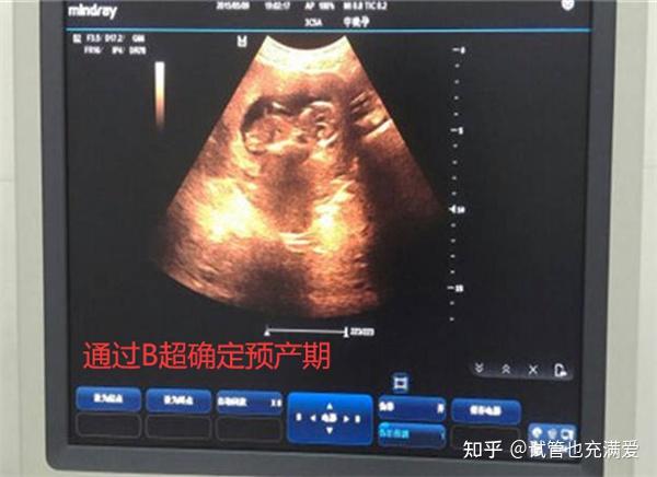 卵泡黄素化是什么_卵泡黄素化是什么